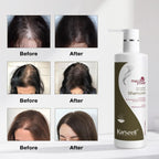Karseell Maca Power Anti Hair Loss Shampoo - Shampoo