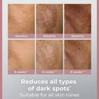 Eucerin Even Pigment Perfector Dual Serum