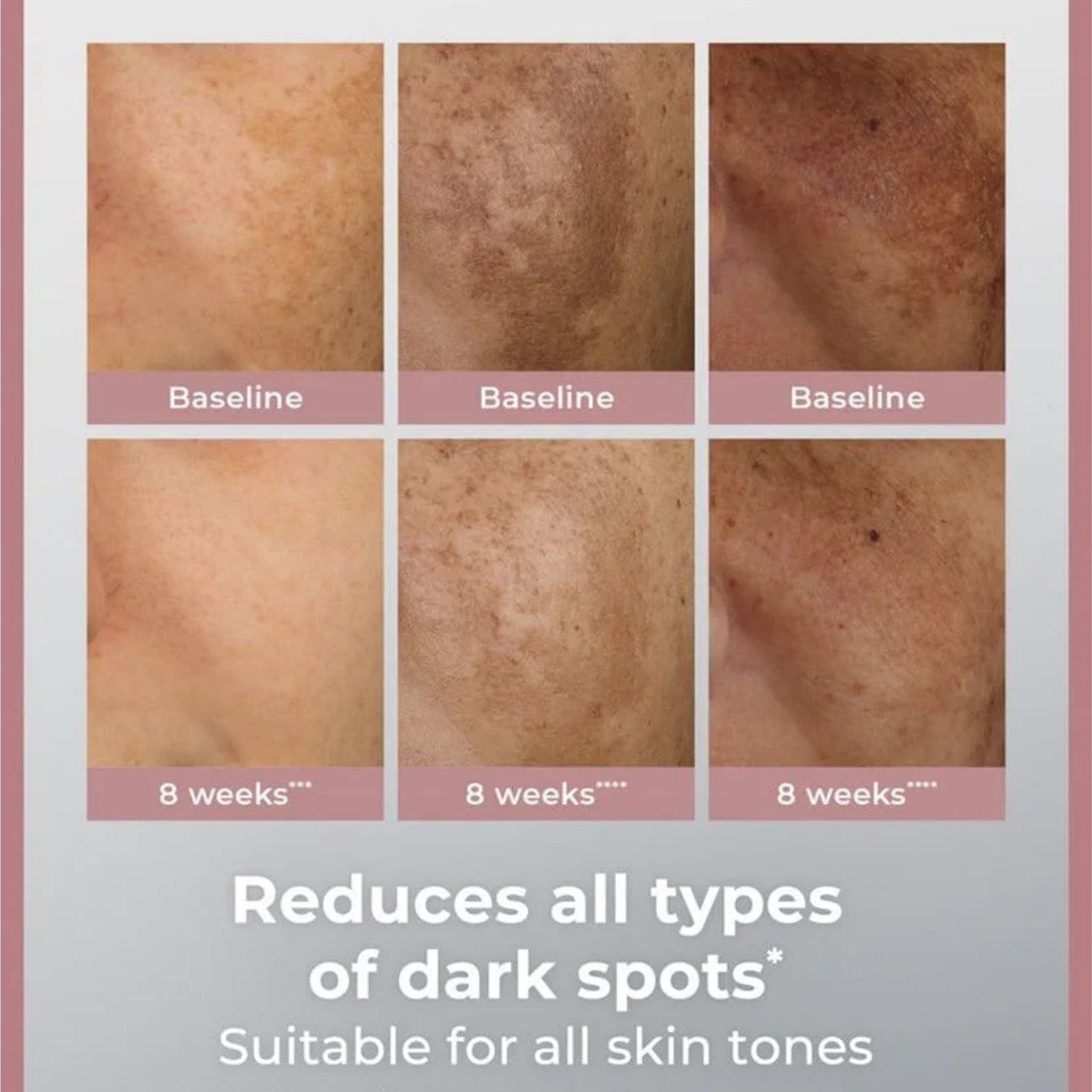 Eucerin Even Pigment Perfector Dual Serum