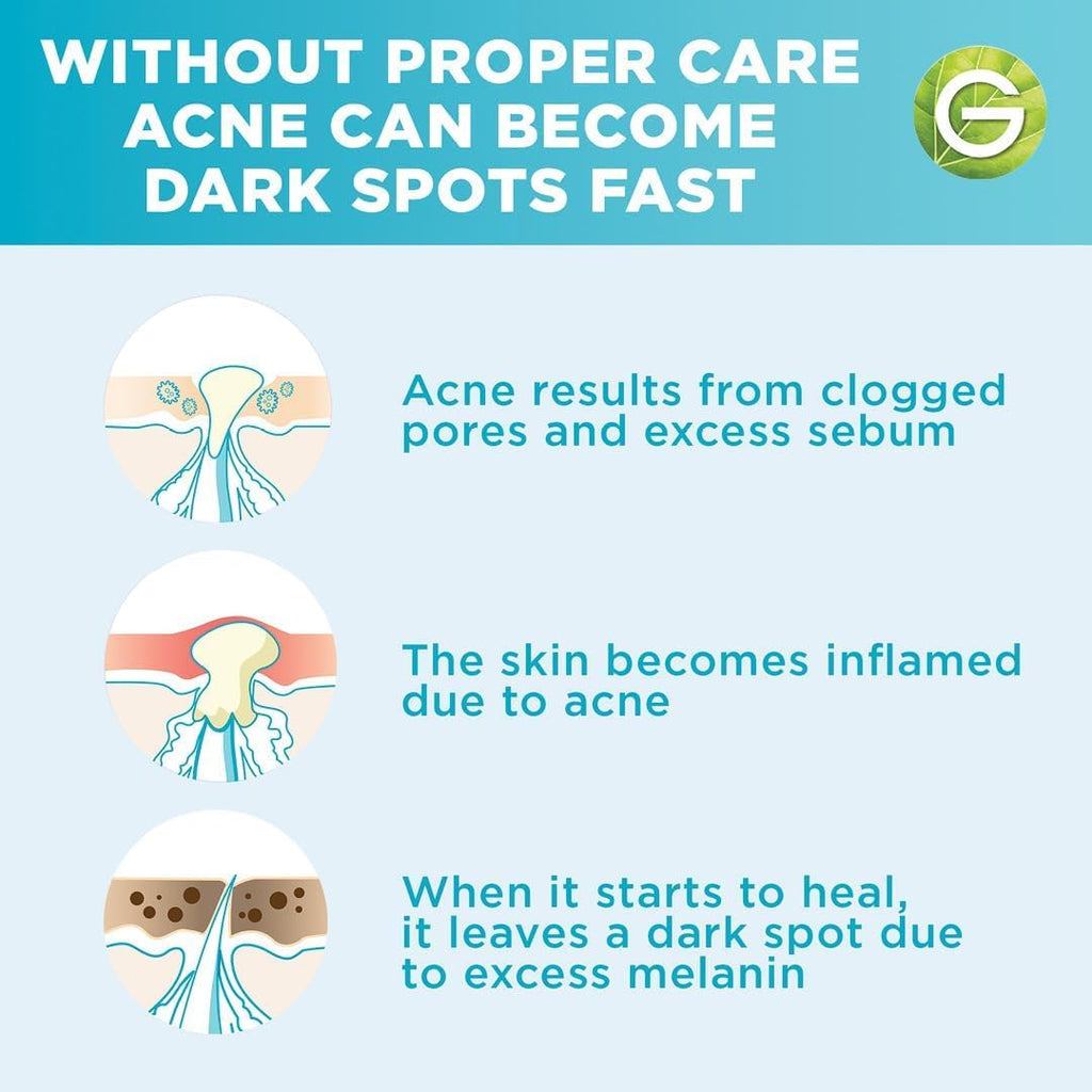Garnier SkinActive Fast Clear Acne Prone Skin Booster Serum - Serum