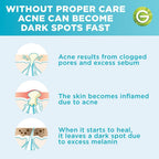 Garnier SkinActive Fast Clear Acne Prone Skin Booster Serum - Serum