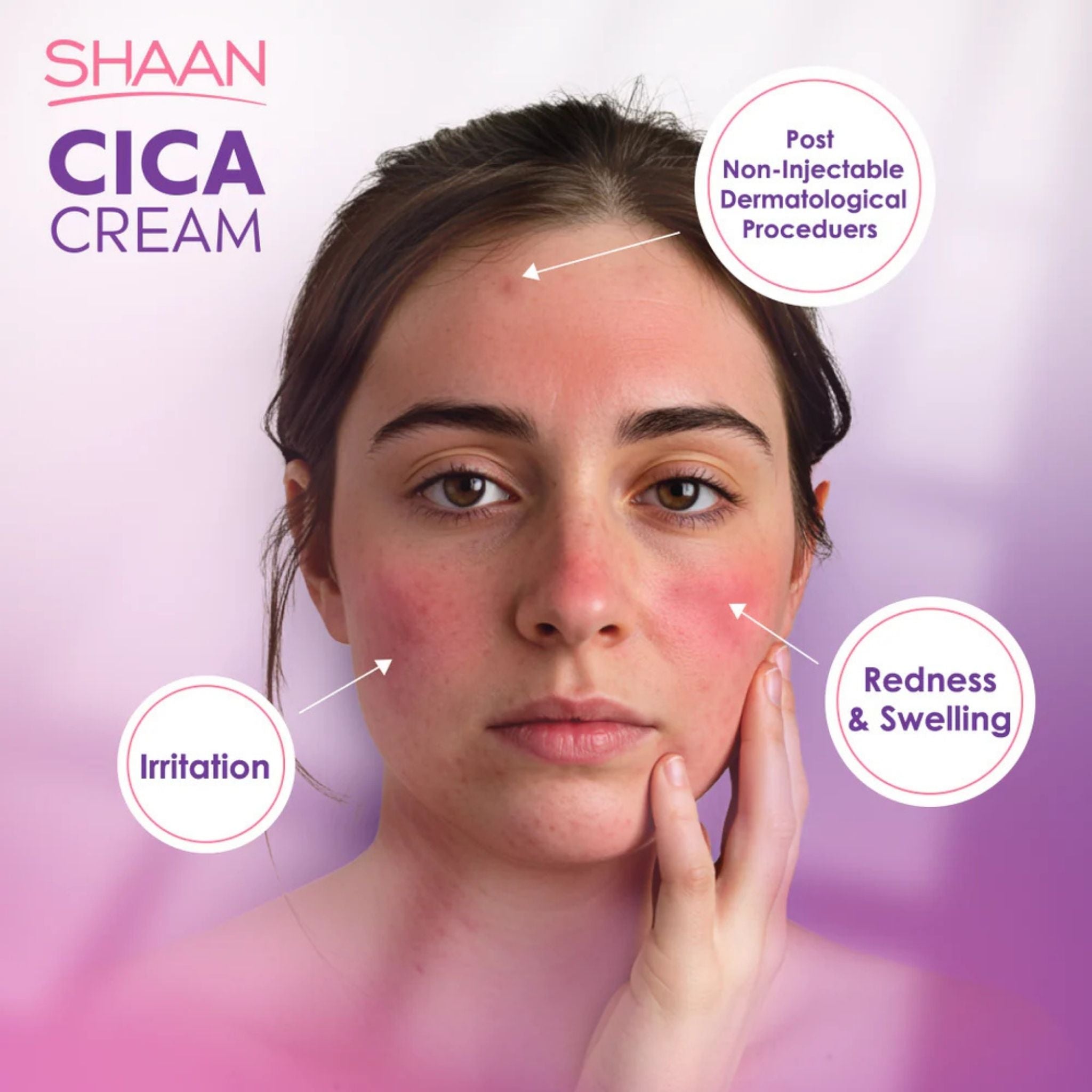 Shaan CICA Cream