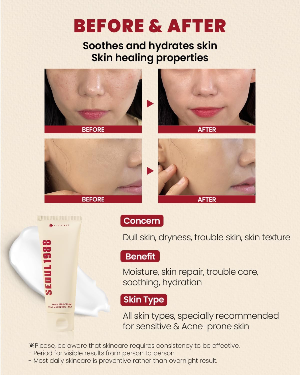 K-Secret - Seoul 1988 Cream Snail Mucin 93% + Rice