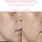 Bionnex THE NORDEA Vitamin C 15% Serum