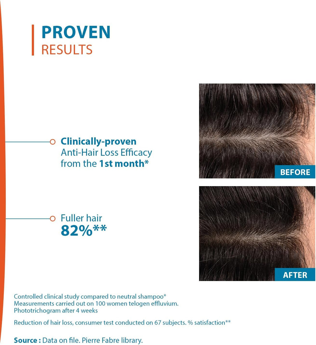 Ducray Creastim Anti Hair Loss Lotion