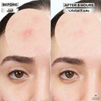 Garnier Pimple Patch Fast Clear Invisible 8 Hours 22 Patches