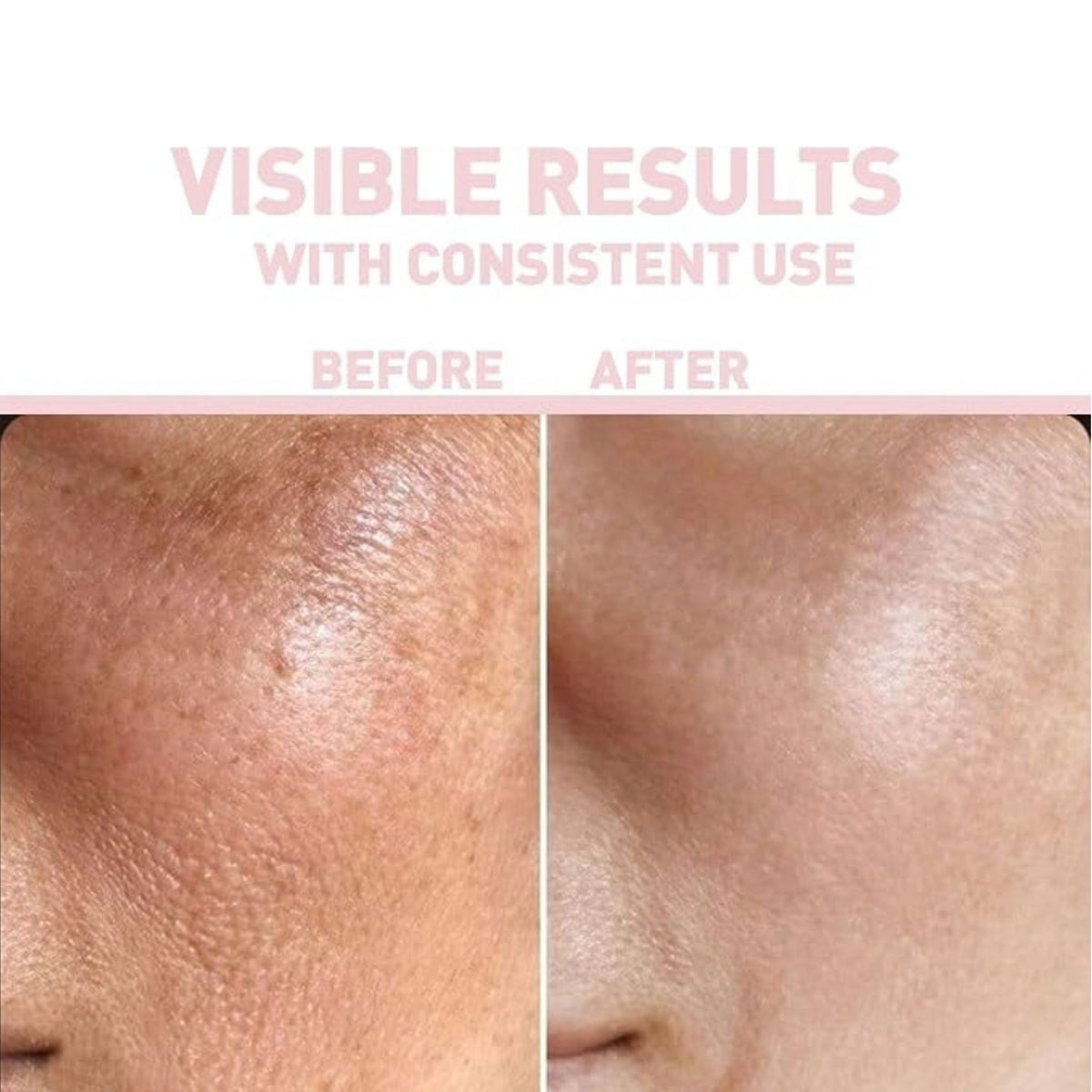 Bionnex THE NORDEA Niacinamide + Hyaluronic Acid - Serum