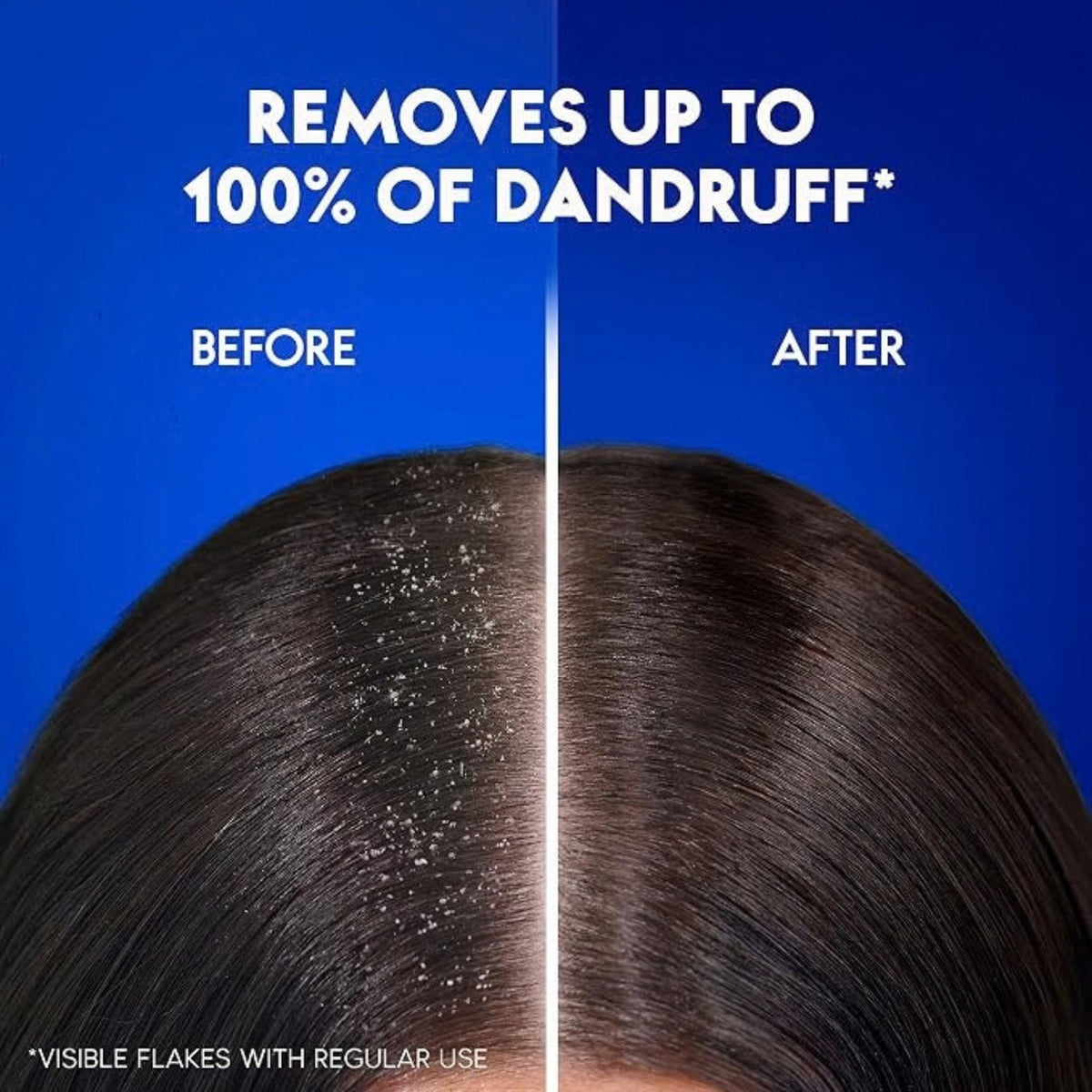Head & Shoulders Oxygenated Charcoal Detox Shampoo - Shampoo