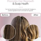 Foltene Strengthening For Thinning Hair Shampoo For Women