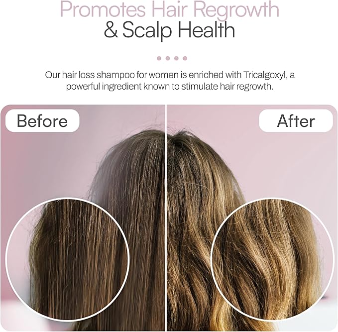 Foltene Strengthening For Thinning Hair Shampoo For Women