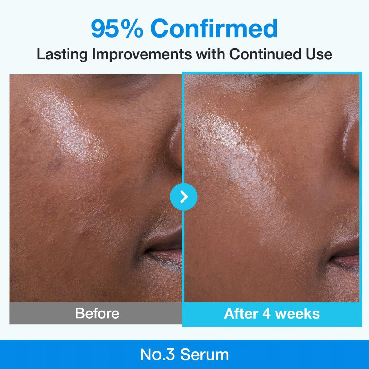 Numbuzin No.3 Blue Bio-Retinol Pore Refining Serum - Serum