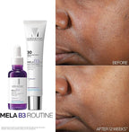 La Roche Posay Mela B3 Daily Moistrurizer UV  Spf 30
