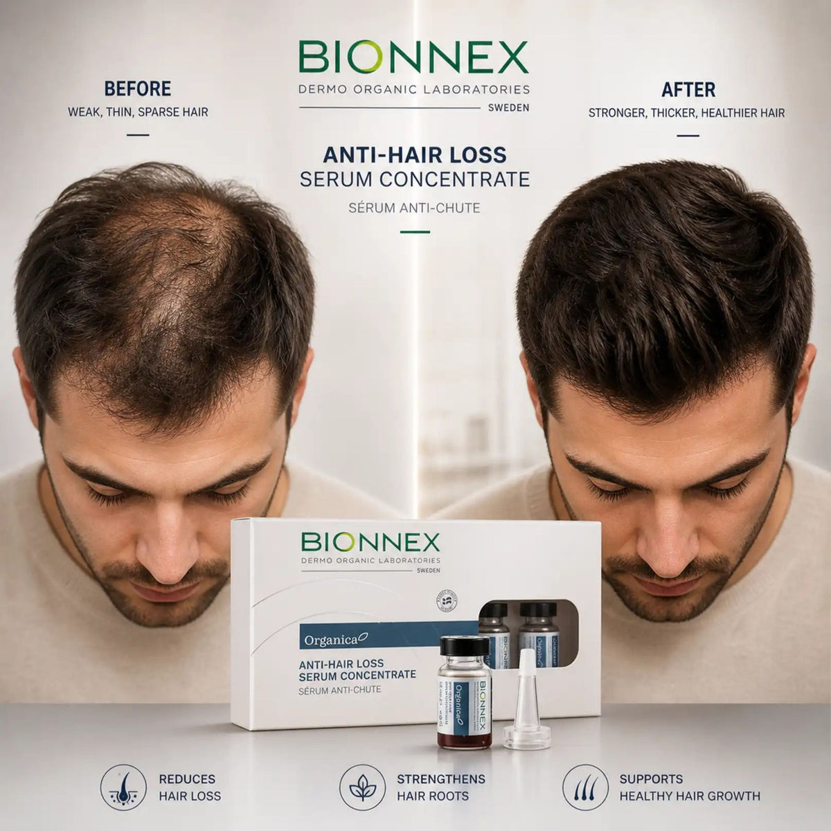 Bionnex Anti Hair Loss Serum Concentrate - (12 Vials 10ml each)