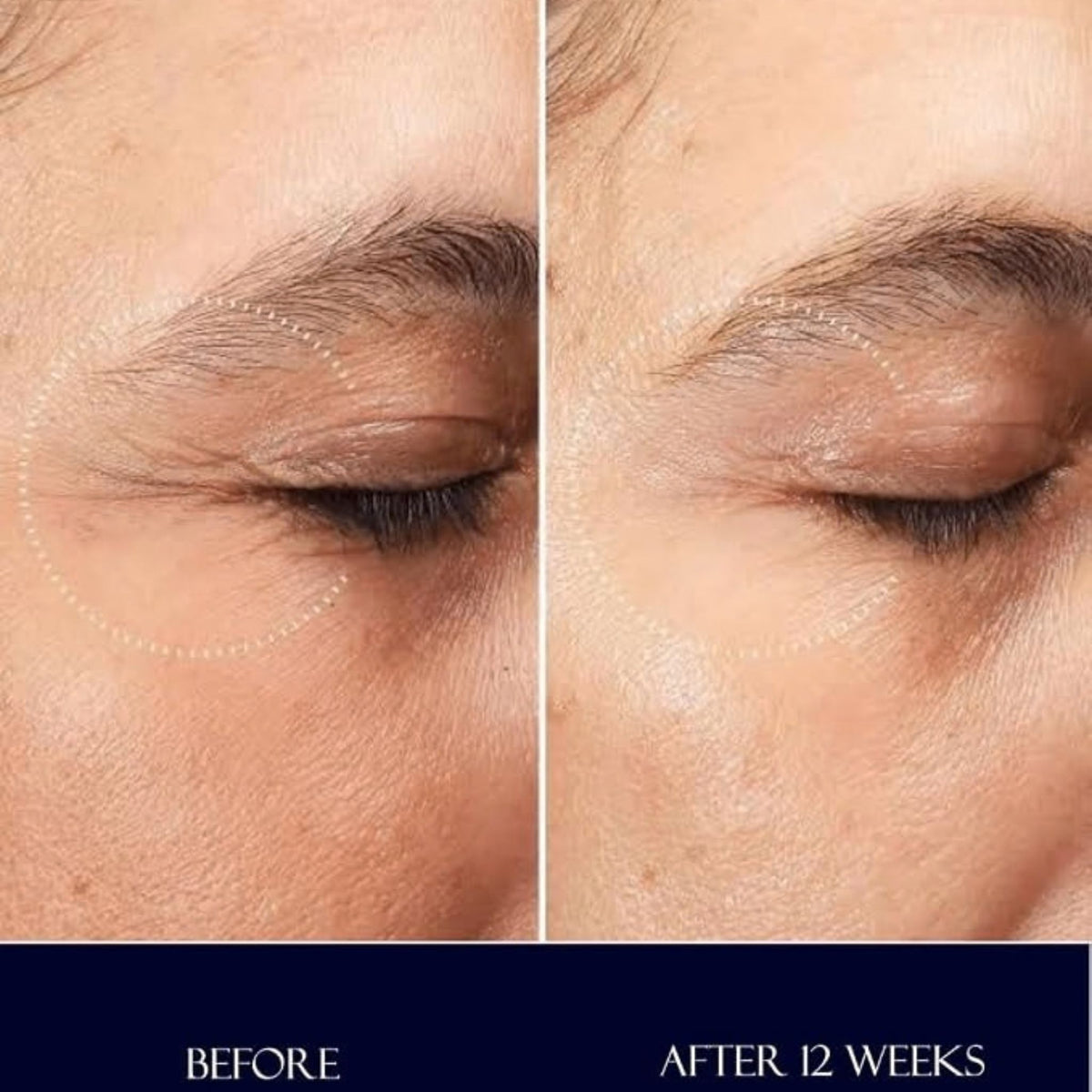 AsmaCharlotte Anti-Wrinkle Eye Cream with Retinal, Niacinamide & Hyaluronic Acid - Eye Cream