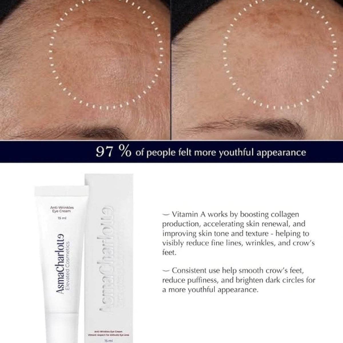 AsmaCharlotte Anti-Wrinkle Eye Cream with Retinal, Niacinamide & Hyaluronic Acid - Eye Cream