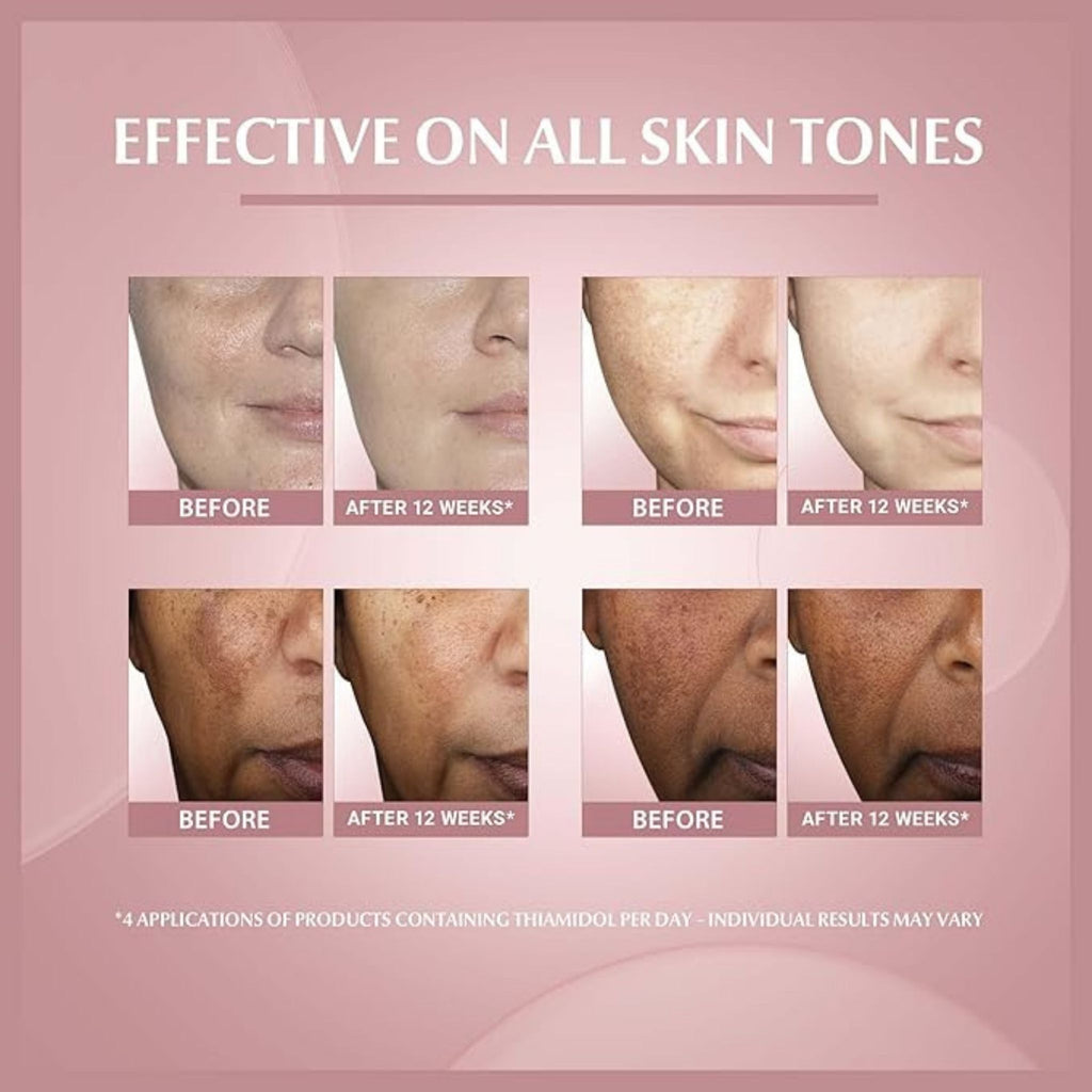 Eucerin Even Pigment Perfector Skin Perfecting Face Serum
