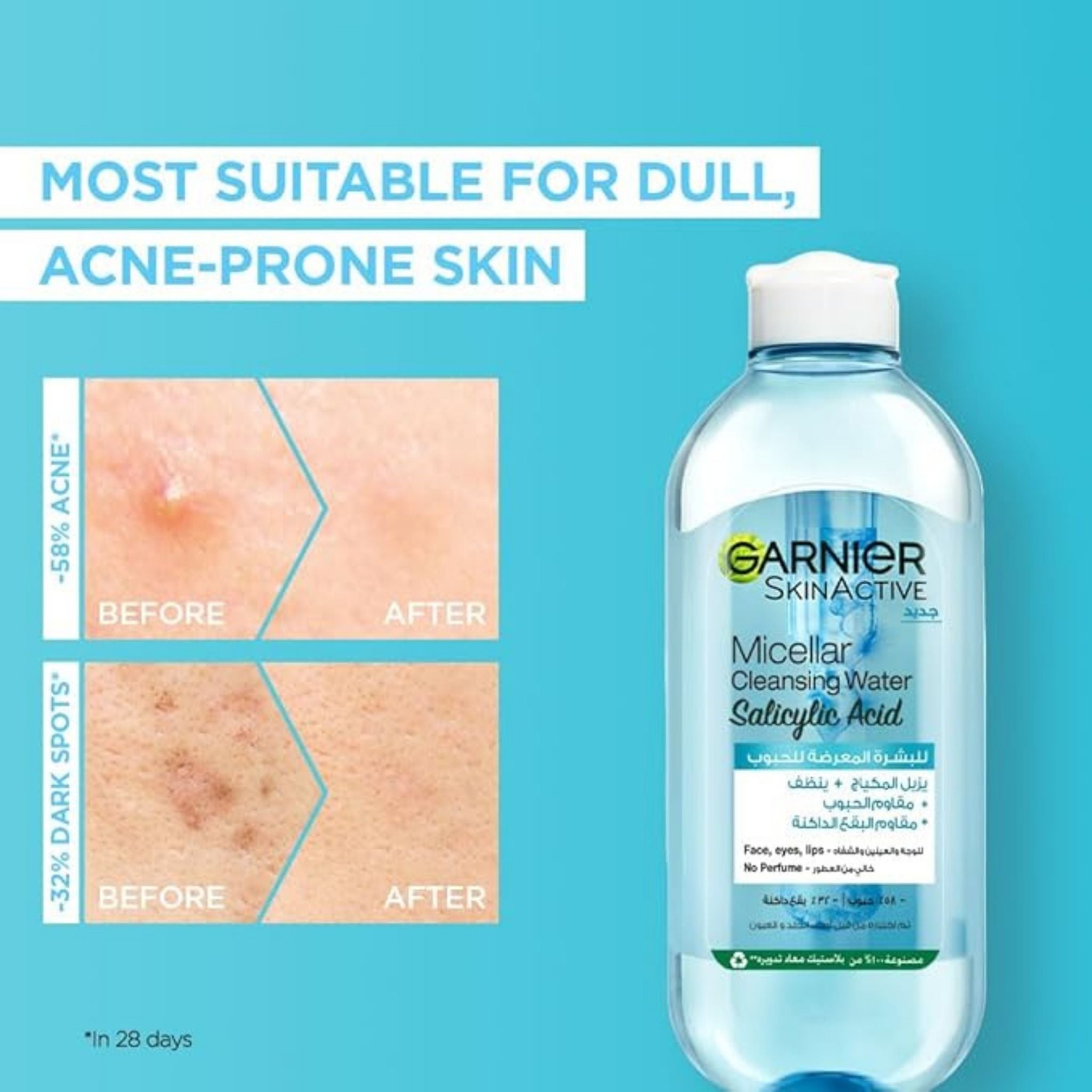 Garnier SkinActive Micellar Cleansing Water with Salicylic Acid - Facial Cleanser