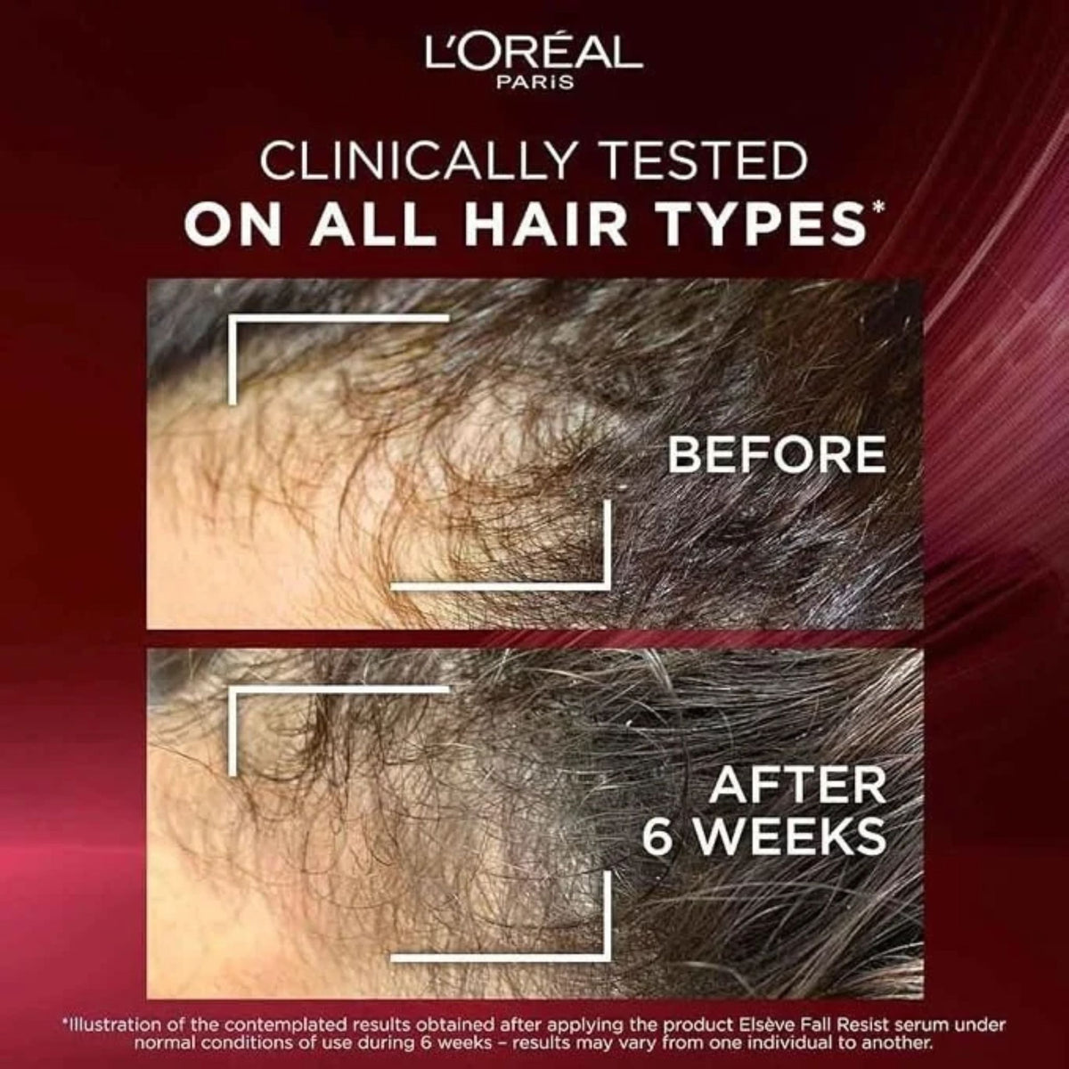 L'Oréal Paris Elvive Fall Resist Aminexil - Reinforcing Shampoo - 20% OFF