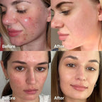 Medicube Red Succinic Acid Serum