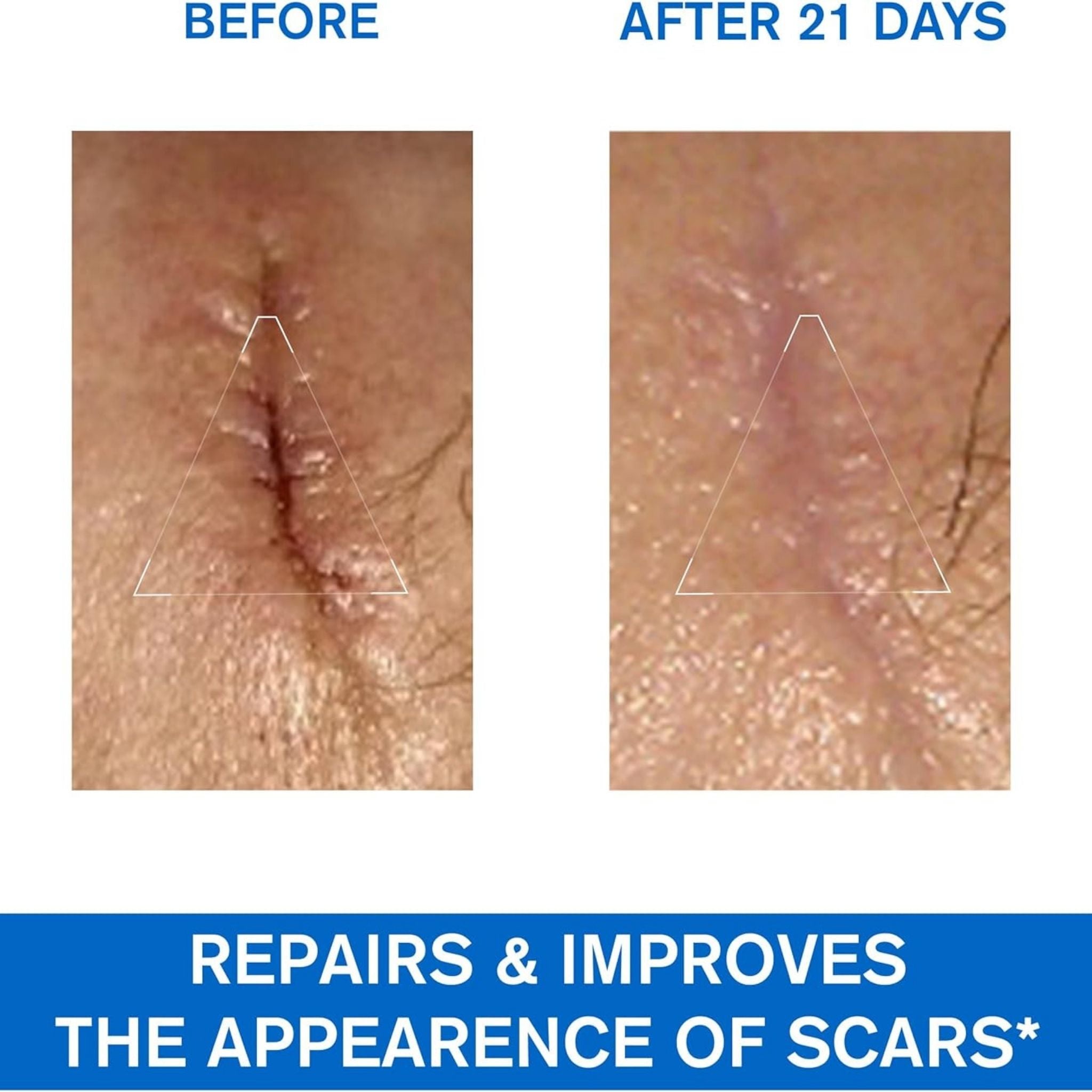 Uriage Bariederm Cica Cream Secondary image