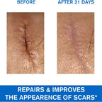 Uriage Bariederm Cica Cream