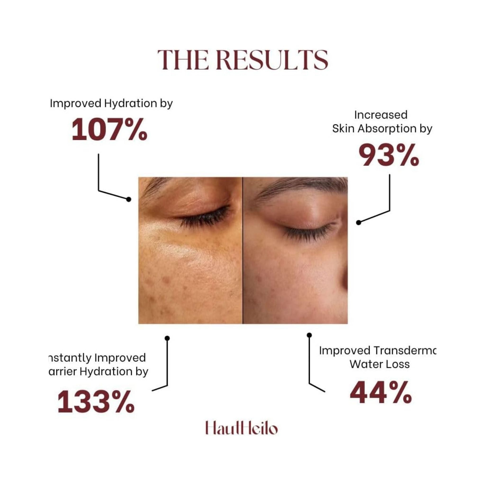 HautHeilo Soothing & Repair Cream - Moisturizer
