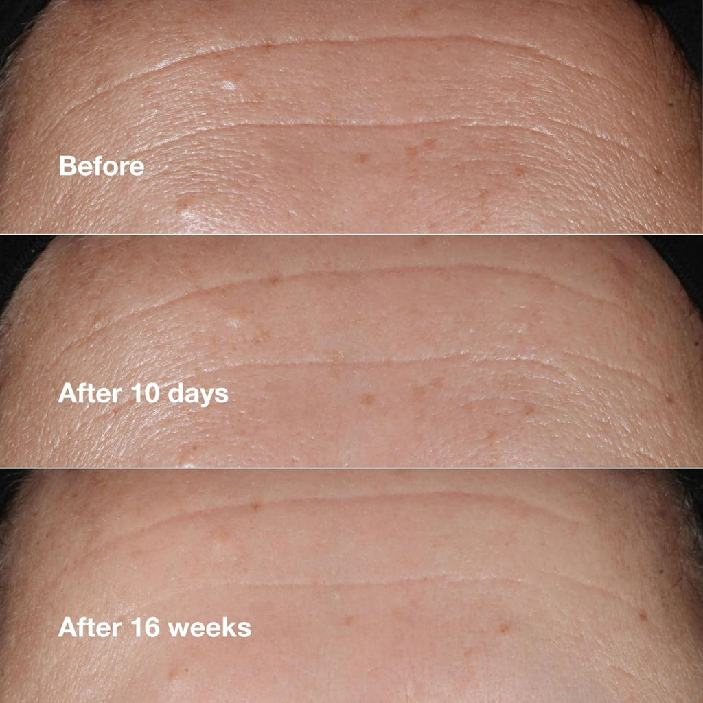Clinique Smart Clinical Repair Serum - Serums