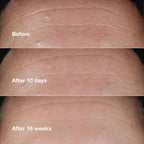 Clinique Smart Clinical Repair Serum - Serums