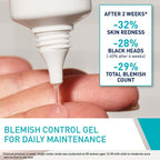 Cerave Blemish Control Gel