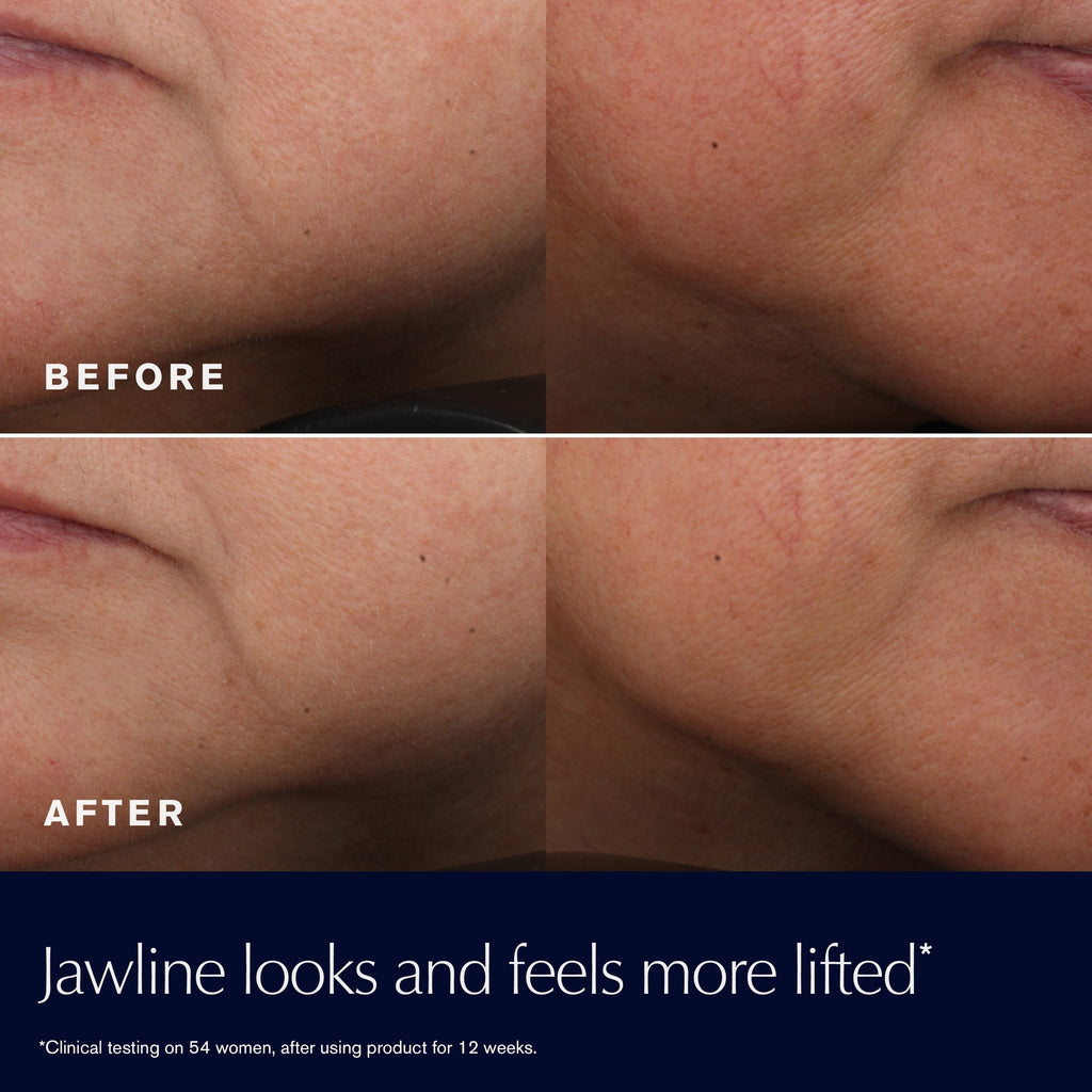 Refect Beauty before and after comparison showing a more lifted and firmer jawline after using Estée Lauder moisturizer
