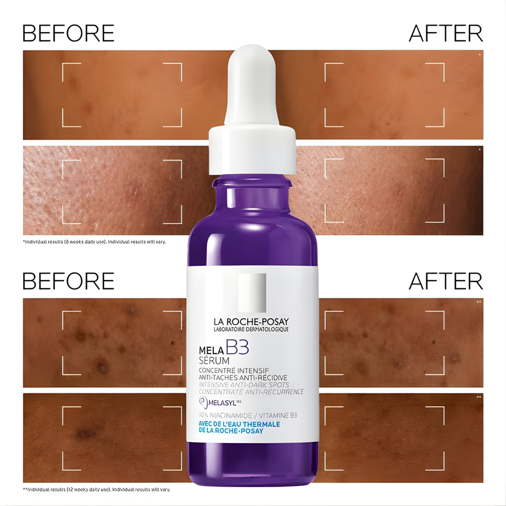La Roche-Posay Intensive Concentrate Serum Mela B3