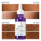 La Roche-Posay Intensive Concentrate Serum Mela B3