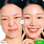 Refect Beauty before and after comparison showing skin soothing and redness reduction from Eqqualberry Aloe PDRN Serum