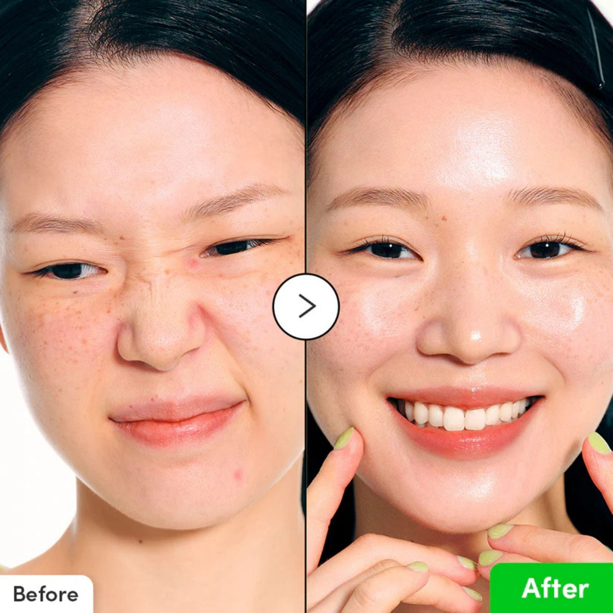 Refect Beauty before and after comparison showing skin soothing and redness reduction from Eqqualberry Aloe PDRN Serum