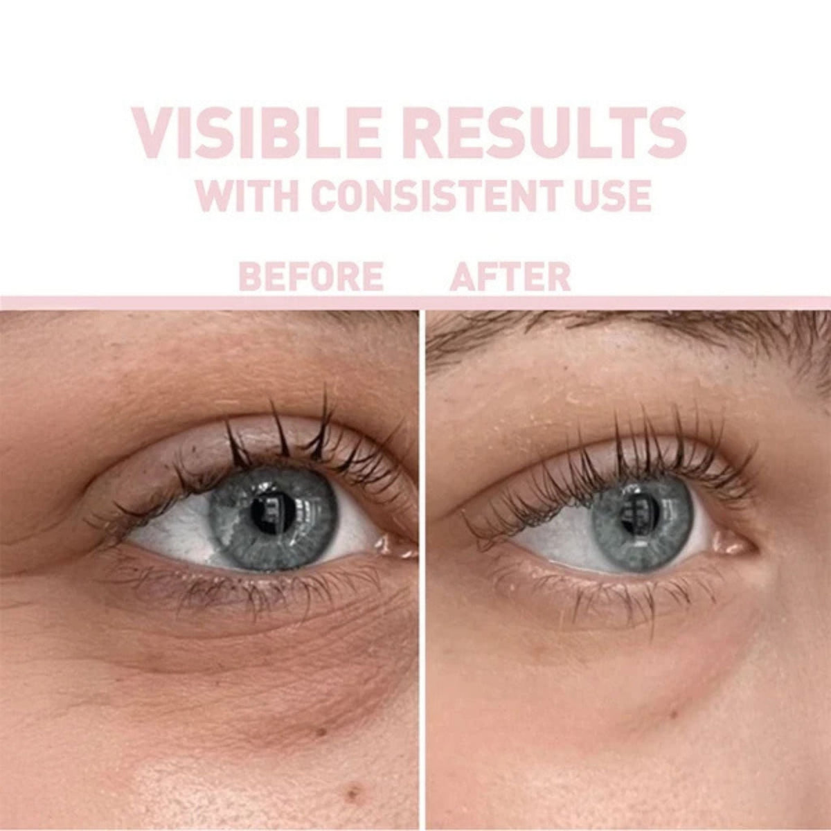 Refect Beauty Bionnex Nordea brightening caffeine serum before and after results showing reduced under-eye puffiness