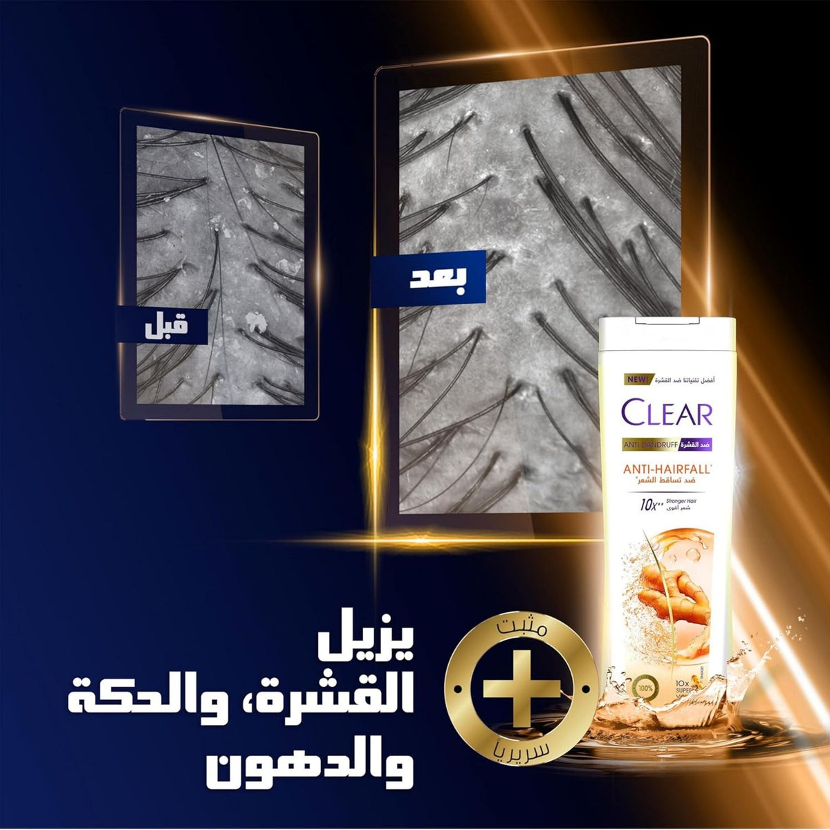 Refect Beauty Clear Women Anti-Dandruff and Anti-Hair Fall shampoo bottle with before and after scalp comparison