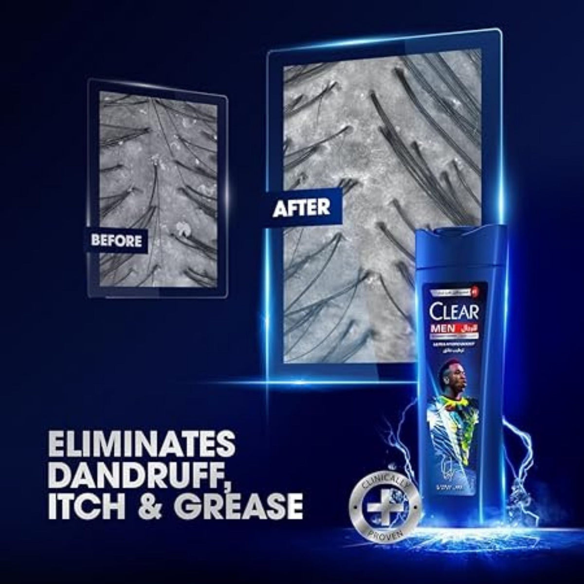 Refect Beauty Clear Men Ultra Hydro Boost shampoo bottle with before and after scalp comparison graphics