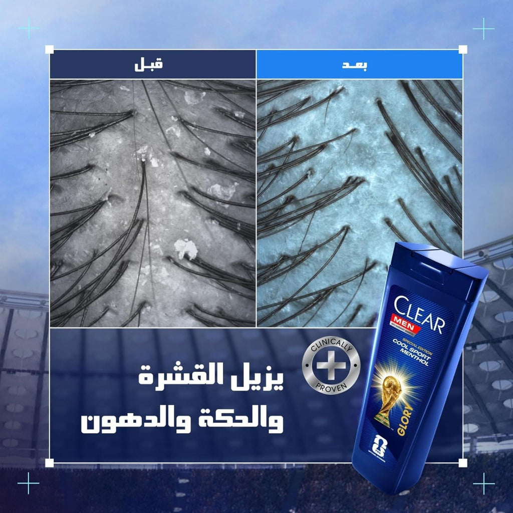 Refect Beauty Clear Men's Deep Cleanse FIFA Glory shampoo bottle showing scalp before and after dandruff treatment
