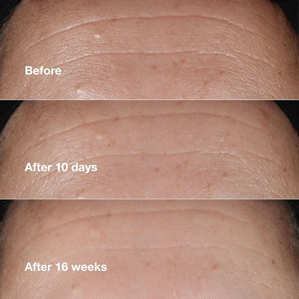 Refect Beauty Clinique Smart Clinical Repair Serum before and after results showing reduced forehead wrinkles