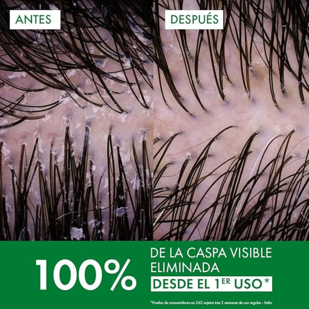 Refect Beauty comparison showing scalp before and after using Vichy Dercos anti-dandruff shampoo for oily hair
