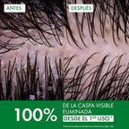 Refect Beauty comparison showing scalp before and after using Vichy Dercos anti-dandruff shampoo for oily hair