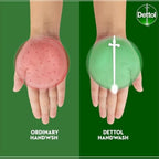 Refect Beauty Dettol handwash comparison showing germ protection on palms with a refreshing pine scent