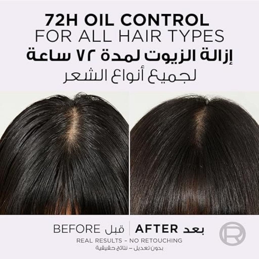 Refect Beauty L'Oreal Paris Elvive Hyaluron Pure scalp serum before and after results showing 72h oil control