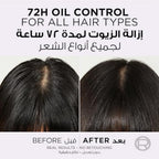 Refect Beauty L'Oreal Paris Elvive Hyaluron Pure scalp serum before and after results showing 72h oil control
