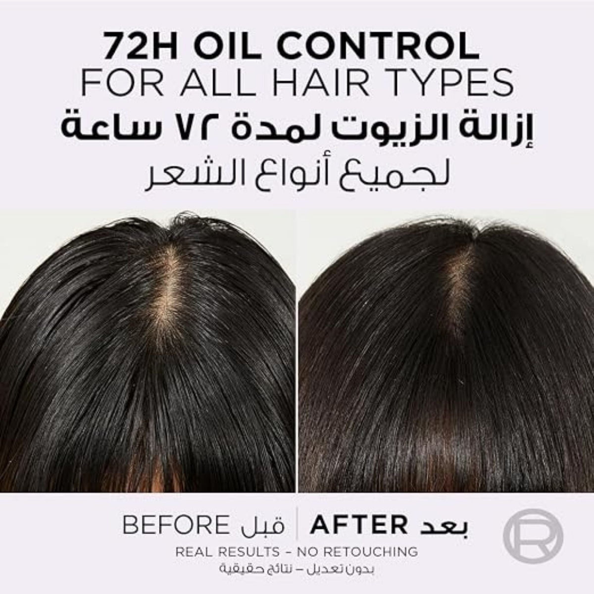 Refect Beauty L'Oreal Paris Elvive Hyaluron Pure scalp serum before and after results showing 72h oil control