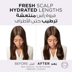Refect Beauty L'Oreal Paris Elvive Hyaluron Pure Serum before and after comparison showing refreshed scalp and hair