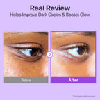 Refect Beauty before and after comparison showing reduced dark circles and smoother skin after using eye cream