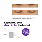 Refect Beauty Some By Mi eye cream before and after results showing reduced dark circles and brighter skin tone