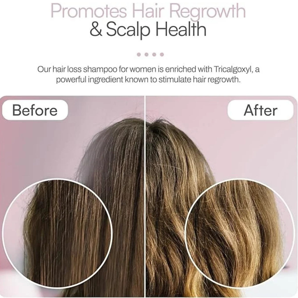Refect Beauty Foltene shampoo before and after results showing improved hair volume and texture for thinning hair.