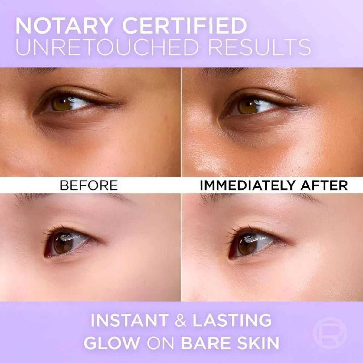 Refect Beauty before and after comparison of skin texture and radiance using L'Oreal Paris Revitalift Glass Skin Cream
